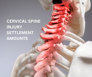 CERVICAL SPINE INJURY SETTLEMENT AMOUNTS CHART