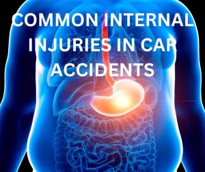 The most common internal injuries in car accidents.